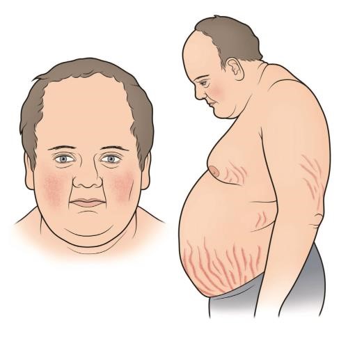 Yuvarlak Yüz Nasıl Zayıflar, Yüz Nasıl Zayıflar Yuvarlak Yüz Nasıl Zayıflar, Yüz Nasıl Zayıflar
